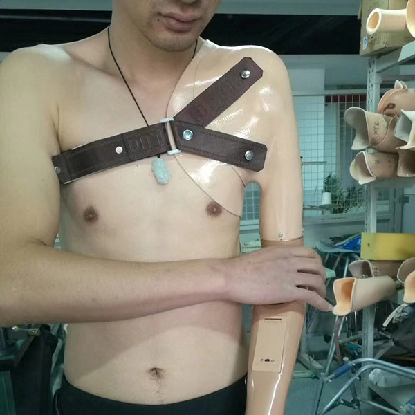 上肢假肢