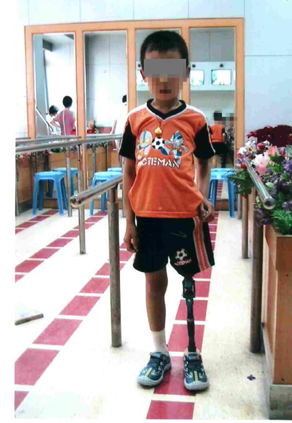 儿童大腿 (2).jpg